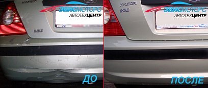 Кузовной ремонт Hyundai Elantra